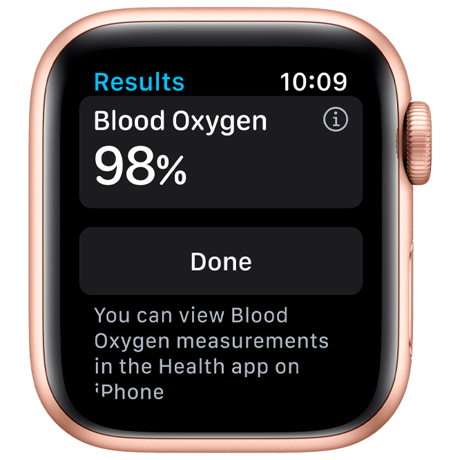 Apple Watch Series 6 GPS + Cellular 40mm Gold Stainless Steel Case with Gold Milanese Loop / Gold