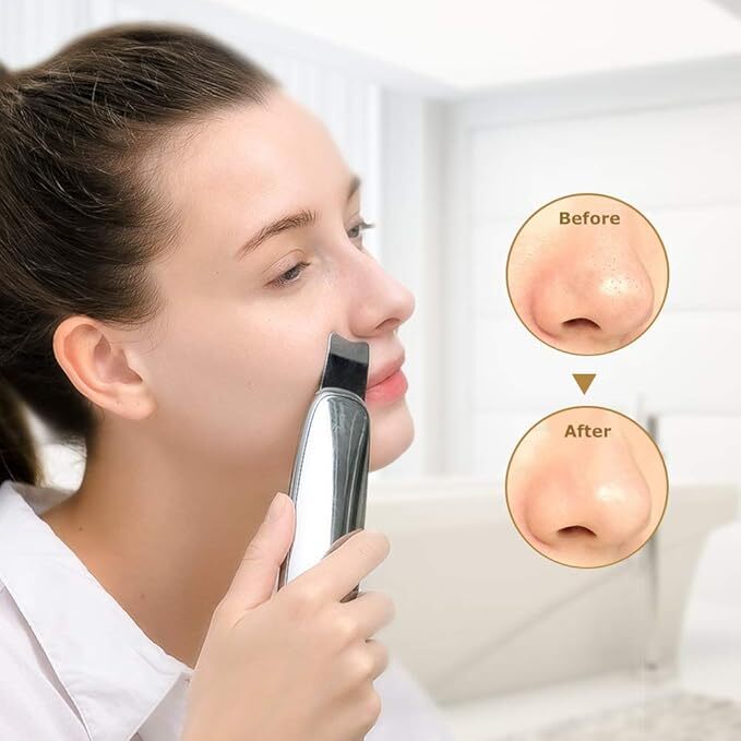 TOUCHBeauty Ultrasonic Scrub Device